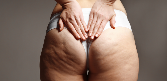 White person wearing a white thong is standing away from camera to show their butt. Hands are pressed flatly at the top of butt/tailbone. Cellulite and skin blemishes are visible.